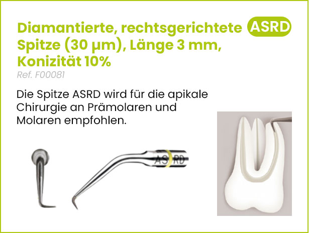 Acteon_Spitzen_Endodontie_17